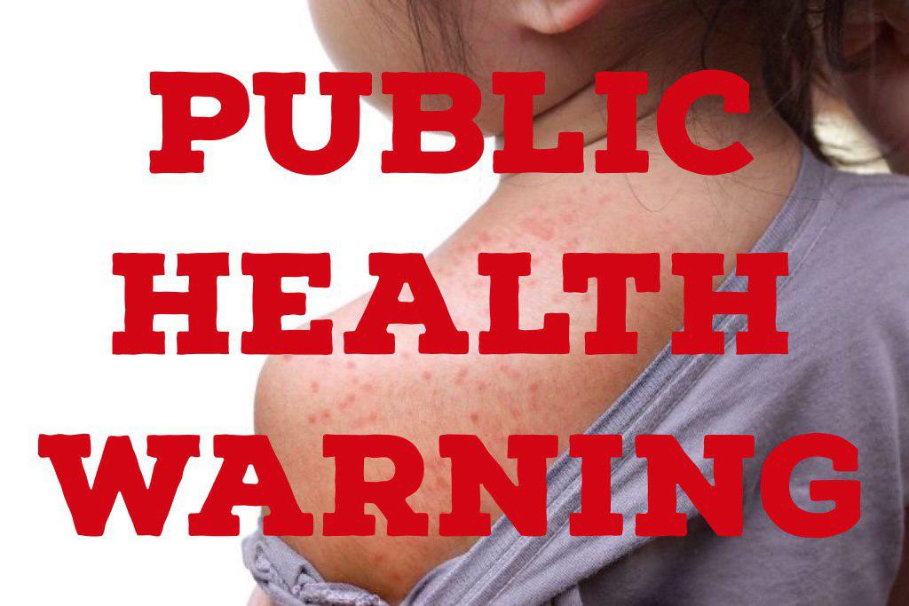 ¡Alerta de salud pública!