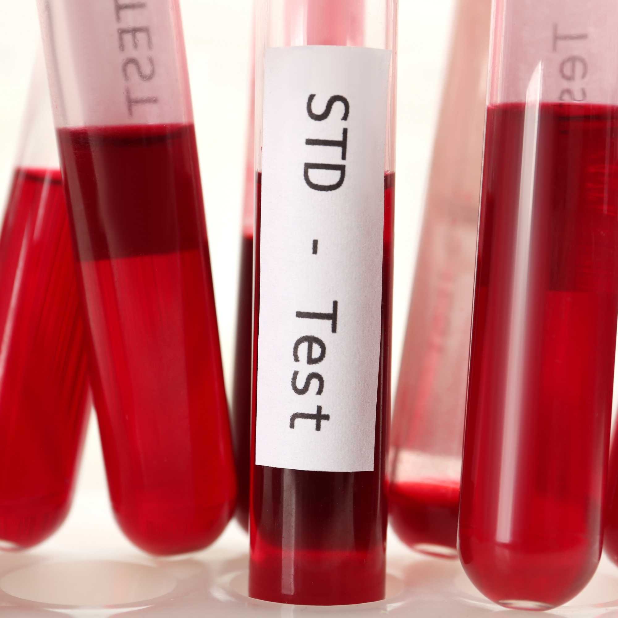 If You’re Nervous to Get  STD Tested, Read This | Walk-In Care at Healthcare Express