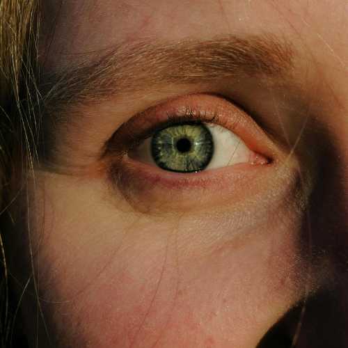 Pink Eye Treatment | Urgent Care Near Me | HealthCARE Express