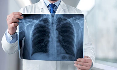 Médico revisando una radiografía de tórax