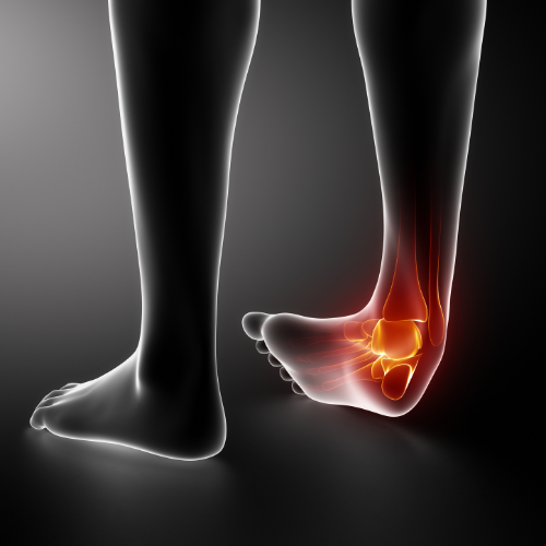 Sprained Ankle: Urgent Care or ER? Cost & Time Compared