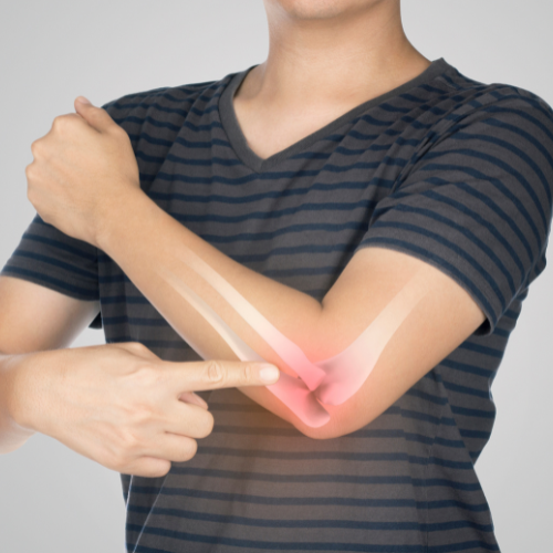 Urgent Care for a Broken Bone: When to Skip the ER