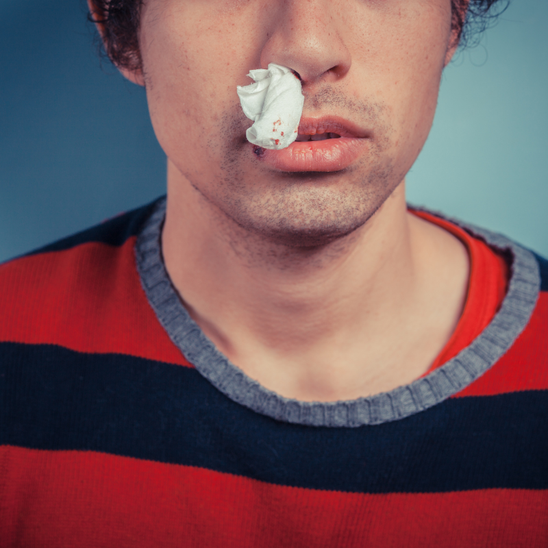 How to Stop a Nosebleed