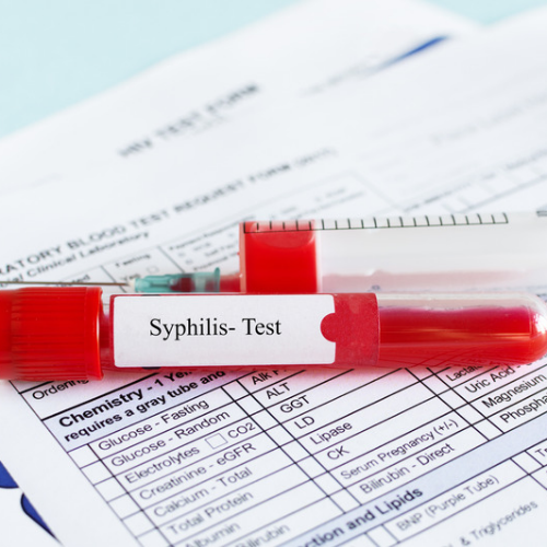 std testing at healthcare express